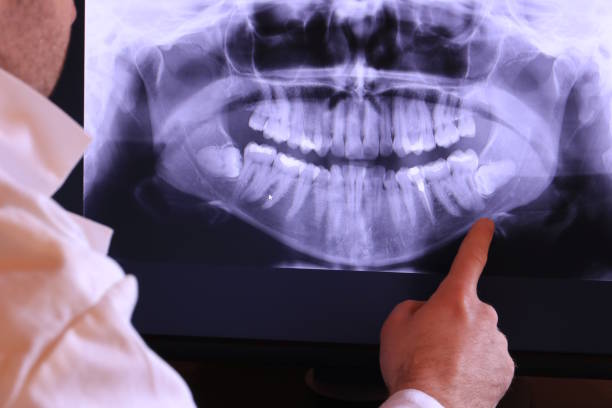 Best Walk-In Emergency Dentist in Haslett, MI